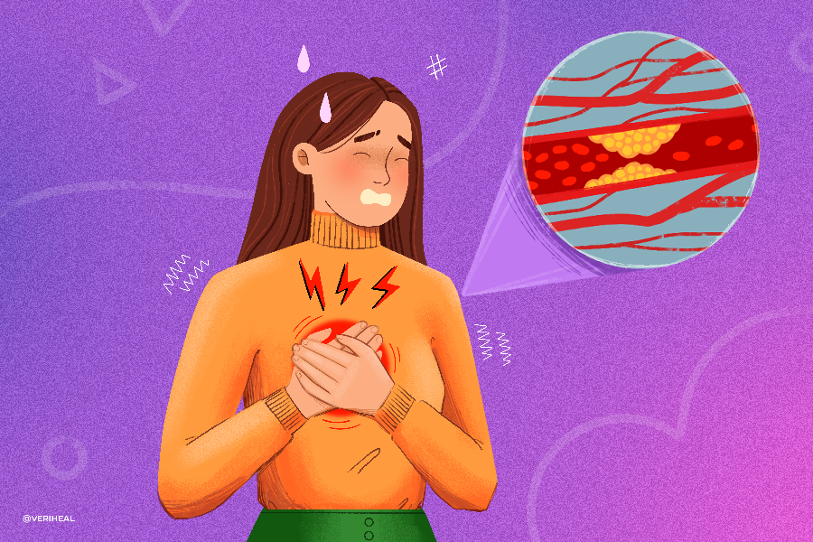 Arteriosclerosis