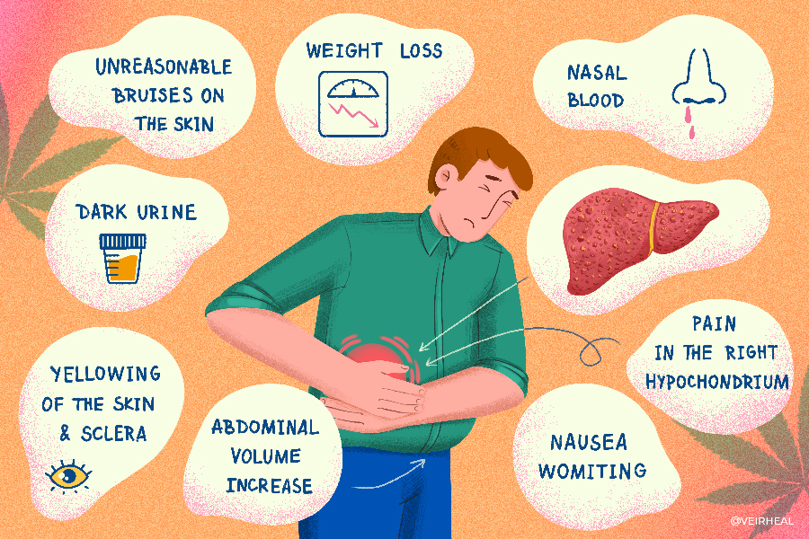 Cirrhosis