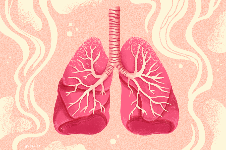 COPD