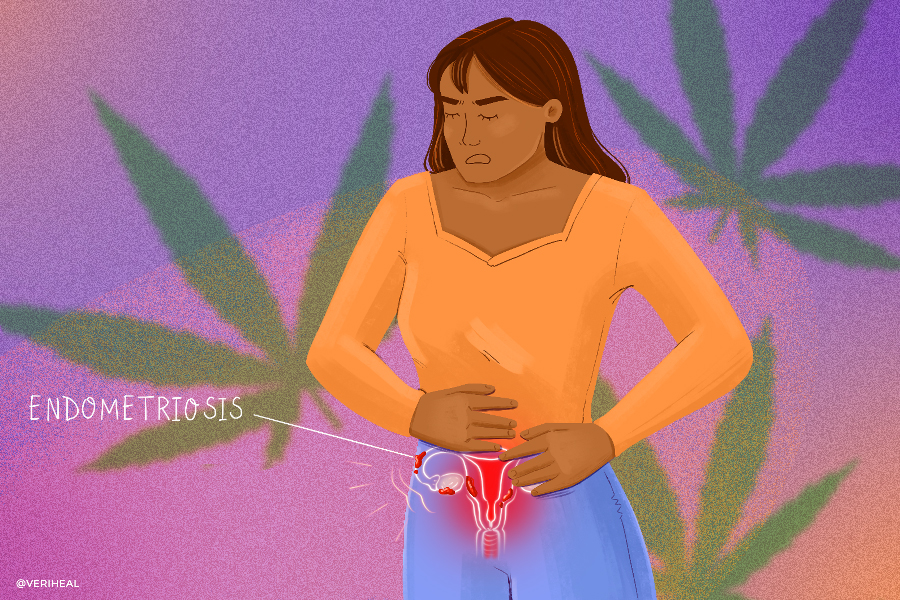 Endometriosis