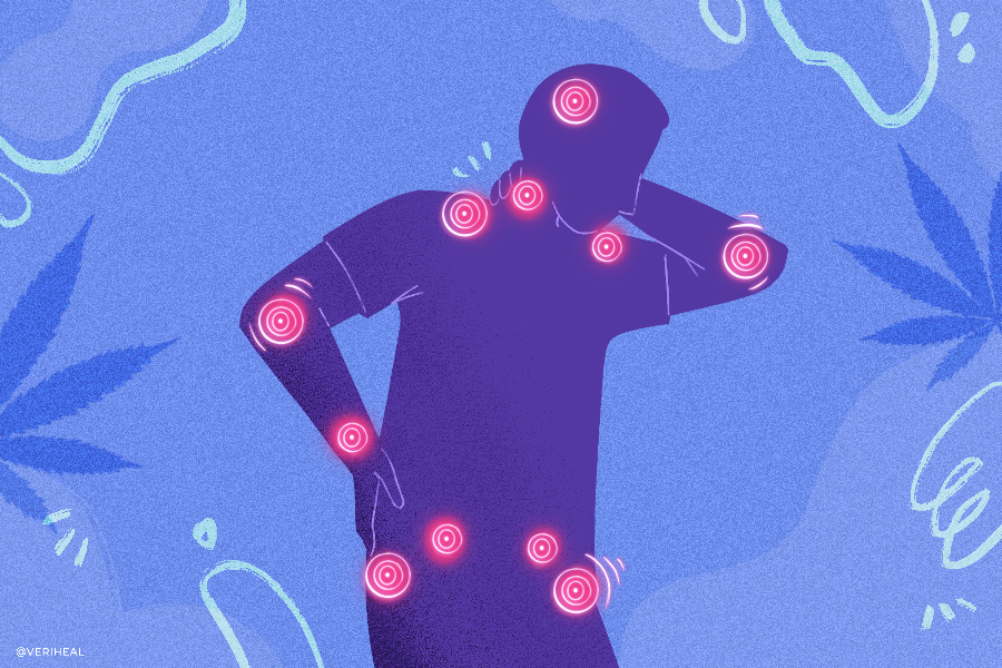 Fibromyalgia
