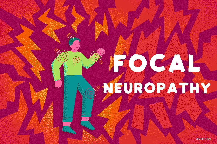 Focal_Neuropathy