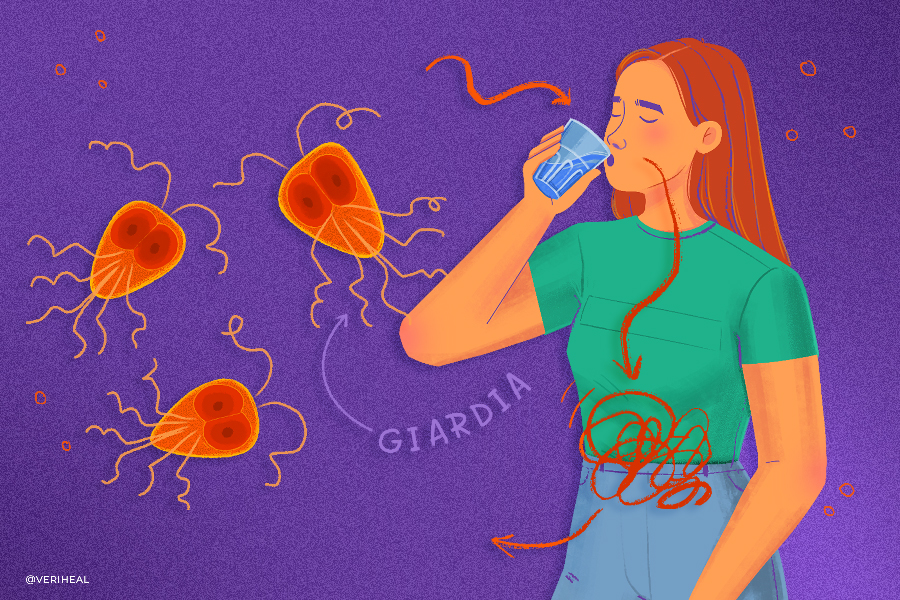 Giardia_Infection
