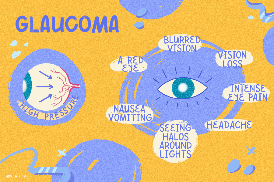 Glaucoma