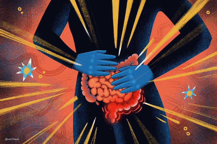 Inflammatory_Bowel_Disease