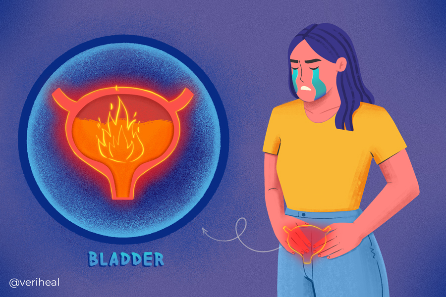 Interstitial_Cystitis