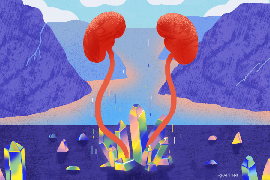 Kidney Stones