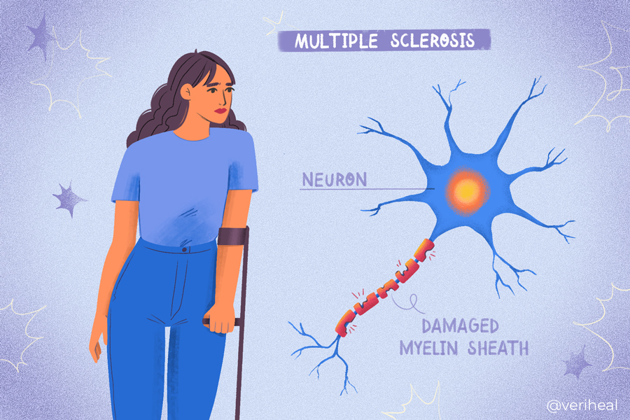 Multiple_Sclerosis