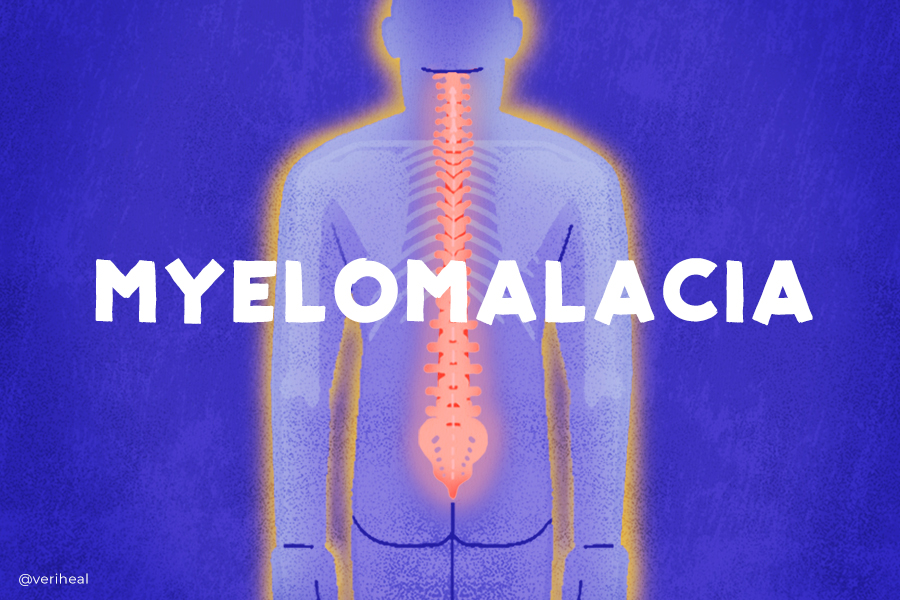 Myelomalacia