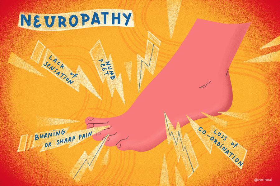 Neuropathy