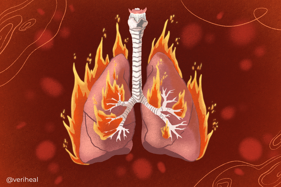 Pneumonia